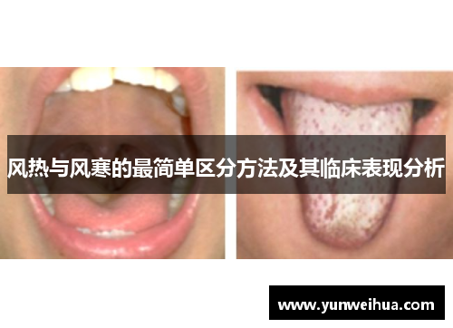 风热与风寒的最简单区分方法及其临床表现分析 风热与风寒的最简单区分方法及其临床表现分析